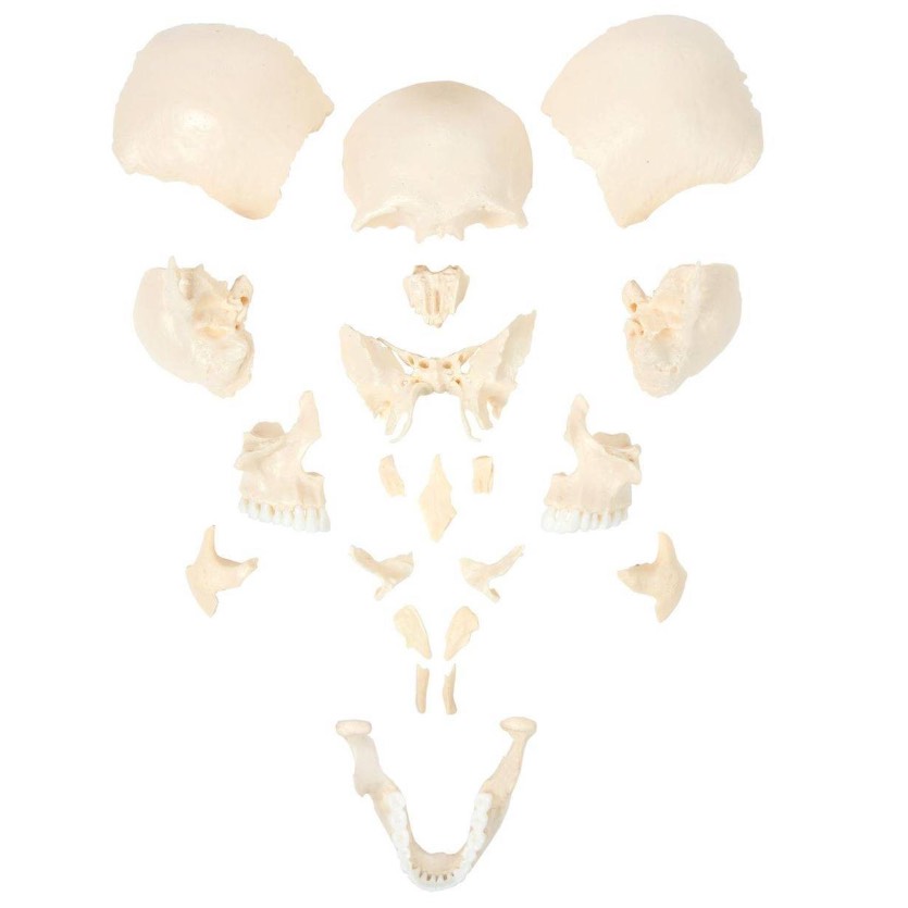 Disarticulated Skull Model